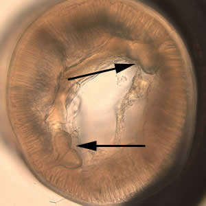 Pseudocontra_crosssection.jpg