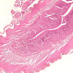 anisakid_tissue_200x_BAM.jpg