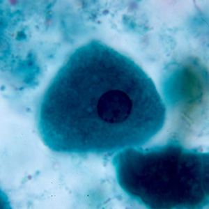epithelial_cell1.jpg