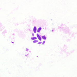 yeast_tissue.jpg