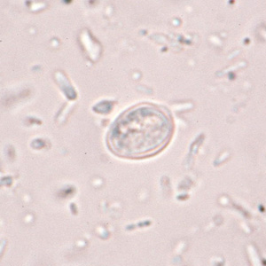 artifact-chilo1.jpg