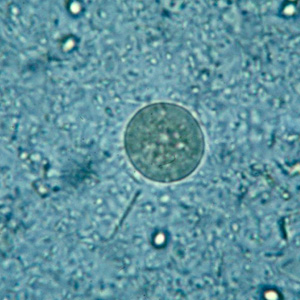 artifact_amoeba1.jpg