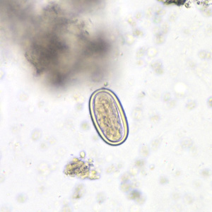 morel_spore_HB1.jpg