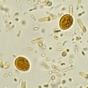 yeast_wtmt1.jpg