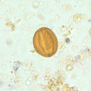 pollen_HB1.jpg