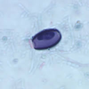 spore_trichrome_WA2.jpg