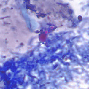 acid_fast_artifact_AZ1.jpg