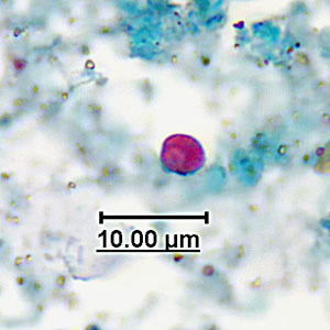 acid_fast_artifact_GA2.jpg