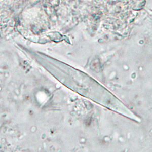CL_crystals_HB1.jpg