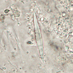 CL_crystals_HB2.jpg