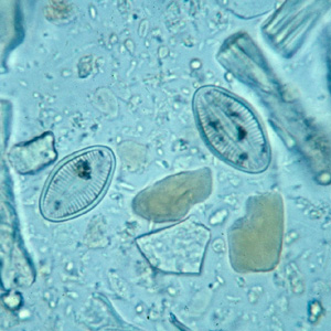 diatoms_wtmt1.jpg