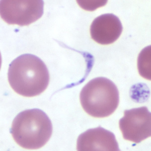 platelets_tryp_thin1.jpg