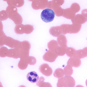 neutrophil_lymphocyte_BAM1.jpg