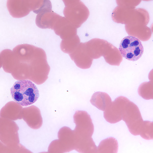 neutrophils_BAM1.jpg