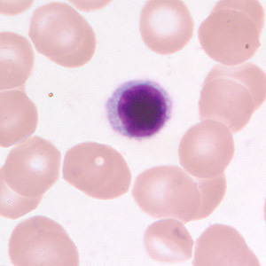 small_lymphocyte_BAM1.jpg