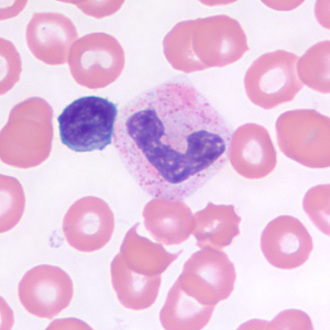 small_lymphocyte_neutrophil_BAM1.jpg