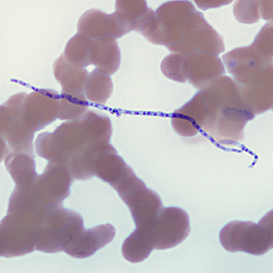 Helicosporum_HB.jpg