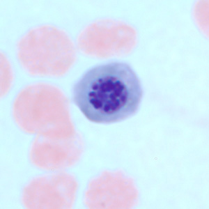 nucleated_rbc1.jpg
