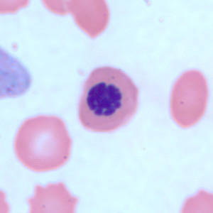 nucleated_rbc3.jpg