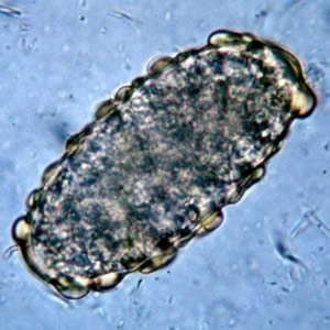 Ascaris_egg_unfert.jpg