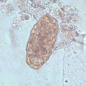 Ascaris_lumbrcoides_infertile_BAM1.jpg
