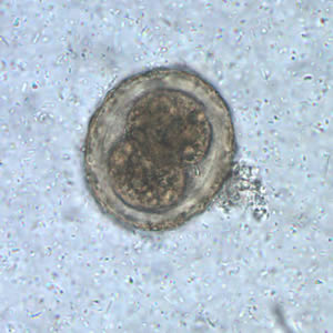 Ascaris_egg_fert2_embryo.jpg