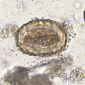 Ascaris_egg_fert5_embryo_200x.jpg