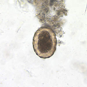 Ascaris_egg_fert_200x.jpg