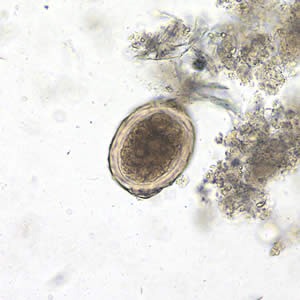 Ascaris_egg_fert3_decort_200x.jpg