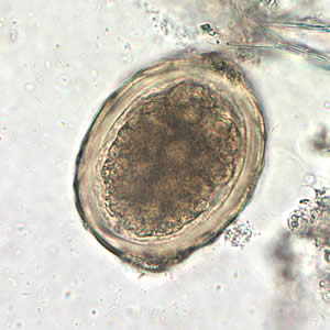 Ascaris_egg_fert4_decort_400x.jpg