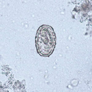 Ascaris_egg_larva2.jpg