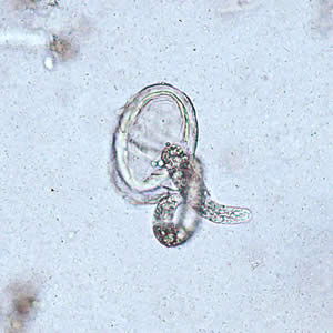 Ascaris_egg_larva3.jpg