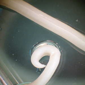 Ascaris_posterior_BAM.jpg