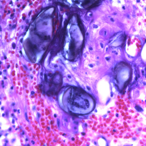 Ascaris_eggs_tissue_400x_BAM1.jpg