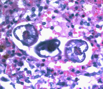 Ascaris_larvae_tissue_400x_BAM1.jpg
