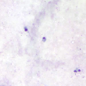 Babesia_thick_giemsa2.jpg