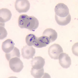 Babesia_thin_giemsa.jpg