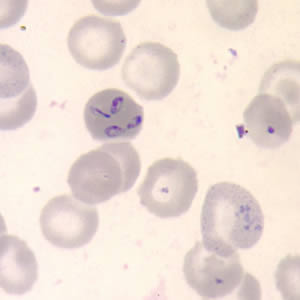 Babesia_thin_giemsa2.jpg