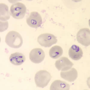 Babesia_thin_giemsa3.jpg