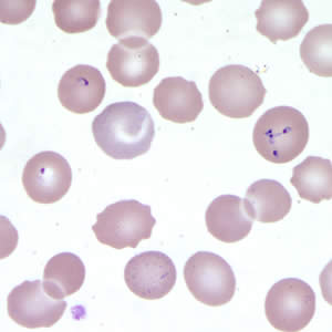 Babesia_thin_giemsa4.jpg