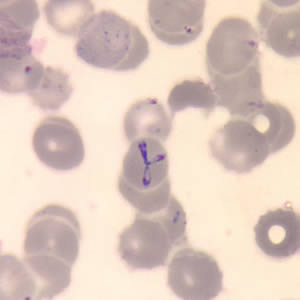 Babesia_thin_giemsa_tetrad.jpg