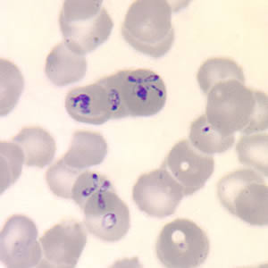 Babesia_thin_giemsa_tetrad2.jpg