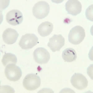 Babesia_thin_giemsa_tetrad3.jpg