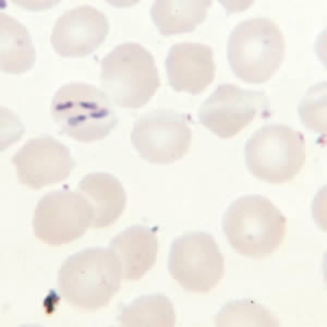 Babesia_thin_giemsa_tetrad4.jpg