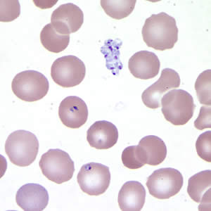 Babesia_thin_giemsa_extracellular.jpg