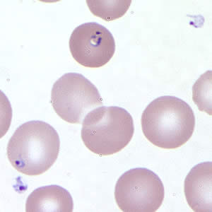 Babesia_thin_giemsa_extracellular2.jpg