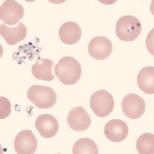 Babesia_thin_giemsa_extracellular3_CT.jpg