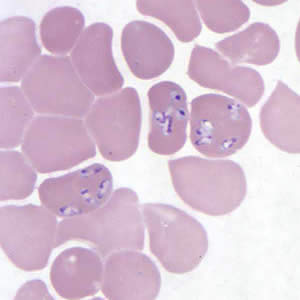 B_MO1_thin_giemsa5.jpg