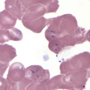 B_MO1_thin_giemsa8.jpg