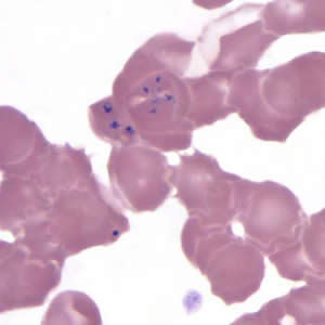 B_MO1_thin_giemsa9.jpg
